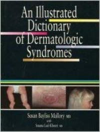An illustrated dictionary of dermatologic syndromes