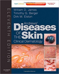 Andrews' diseases of the skin : Clinical dermatology, 11th Ed.