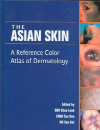 The asian skin : a reference color atlas of dermatology