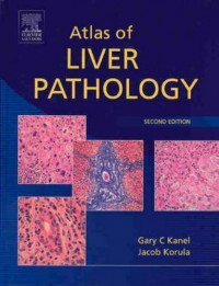 Image of Atlas of liver pathology, 2nd ed. /  Gary C. Kanel, Jacob Korula.