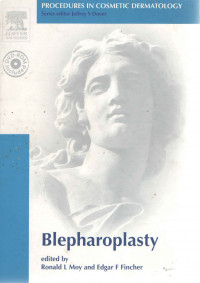 Image of Blepharoplasty /  edited by Ronald L. Moy, Edgar F. Fincher