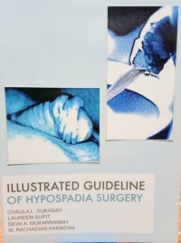 Illustrated guideline of hypospadia surgery / Chaula L. Sukasah., dkk.