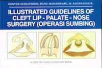 Illustrated guidelines of cleft lip-palate-nose surgery (Operasi Sumbing)