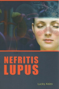 Nefritis Lupus / Lucky Aziza