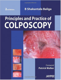 Image of Principles and practice of colposcopy