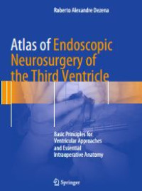 Atlas of Endoscopic Neosurgery of the Third Ventricle : basic principles for ventricular approaches and essential intraoperative anatomy