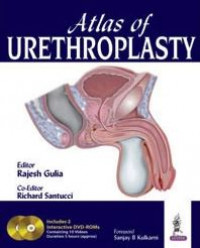 Atlas of Urethroplasty