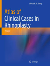 Atlas of Clinical Cases in Rhinoplasty, Volume I