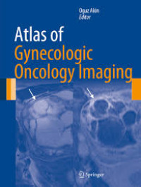 Atlas of gynecologic oncology imaging