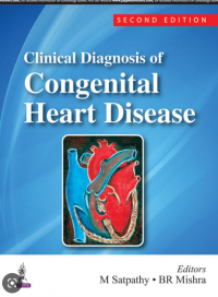 Clinical Diagnosis of Congential Heart Disease