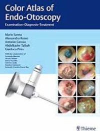 Color Atlas of Endo-Otoscopy : Examination–Diagnosis–Treatment