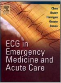 ECG in emergency medicine and acute care