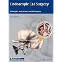 Endoscopic ear surgery: principles, indications, and techniques / edited by Livio Presutti, Daniele Marchioni