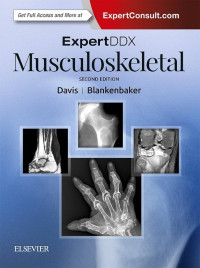 ExpertDDx. Musculoskeletal 2nd Edition / edited by Kirkland W. Davis, Donna G. Blankenbaker