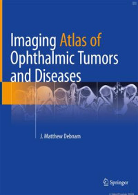 Imaging atlas of ophthalmic tumors and diseases / edited by J. Matthew Debnam