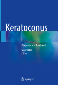 Keratoconus : diagnosis and treatment / edited by Sujata Das