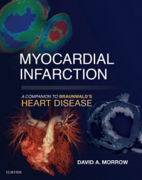Myocardial Infarction : A Companion to Braunwald's Heart Disease
