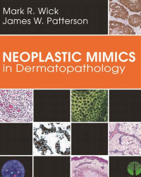 Neoplastic Mimics in Dermatopathology / by Mark R. Wick, James W. Patterson