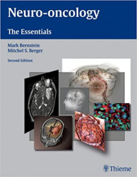 Neuro-oncology :  the essentials, 2nd ed. / edited by Mark Bernstein, Mitchel S. Berger.