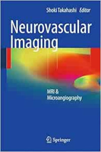 Neurovascular imaging : MRI & microangiography