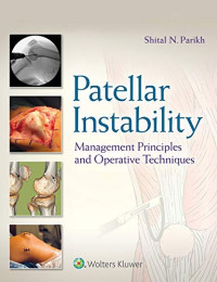 Image of Patellar instability : management principles and operative techniques 1st Edition