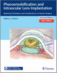 Phacoemulsification and Intraocular Lens Implantation: Mastering Techniques and Complications in Cataract Surgery 2nd Edition