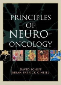 Principles of neuro-oncology /  editors, David Schiff, Brian Patrick O’Neill.