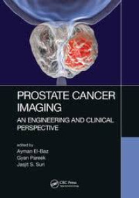 Prostate cancer imaging : an engineering and clinical perspective