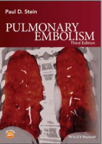 Image of Pulmonary Embolism 3rd Edition