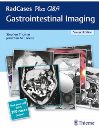 RadCases Gastrointestinal Imaging 2nd Edition / edited by Stephen Thomas, Jonathan M. Lorenz