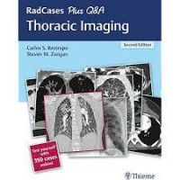 RadCases Plus Q&A Thoracic Imaging 2nd Edition