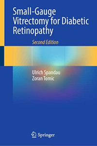 Small-gauge vitrectomy for diabetic retinopathy 2nd Edition / by Ulrich Spandau, Zoran Tomic