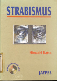 Image of Strabismus