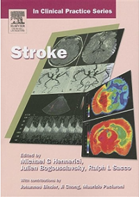 Image of Stroke