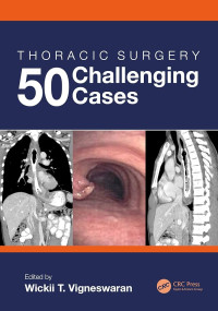 Image of Thoracic surgery : 50 challenging cases