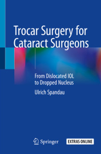 Trocar surgery for cataract surgeons : from dislocated IOL to dropped nucleus / by Ulrich Spandau