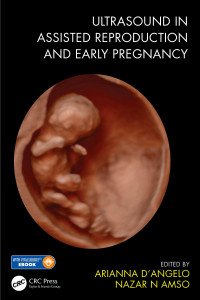 Ultrasound in Assisted Reproduction and Early Pregnancy