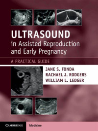 Ultrasound in Assisted Reproduction and Early Pregnancy : A Practical Guide