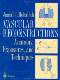 Vascular Reconstructions : anatomy, exposures, and techniques