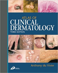 Atlas of clinical dermatology, 3rd ed. / Anthony du Vivier ; advisor on pathology, Phillip H. McKee.