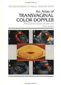 AN ATLAS of transvaginal color doppler : the current state of the art  / edited by Asin Kurjak
