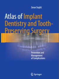 Atlas of Implant Dentistry and Tooth-Preserving Surgery : prevention and management of complications