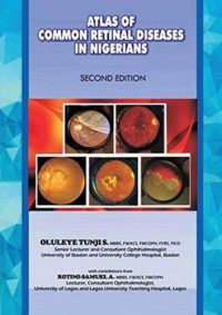 Atlas of Common Retinal Diseases in Nigerians 2nd edition
