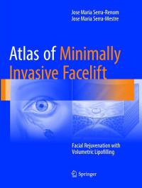 Atlas of minimally invasive facelift : facial rejuvenation with volumetric lipofilling
