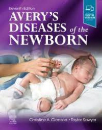 Avery's diseases of the newborn 11th edition