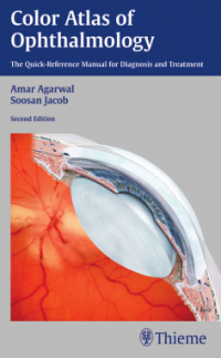 Color Atlas Ophthalmology : The Quick-Reference Manual for Diagnosis and Treatment 2nd Edition