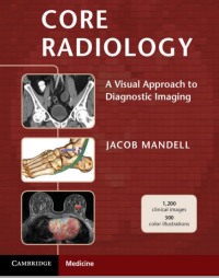 Core Radiology : A Visual Approach to Diagnostic Imaging