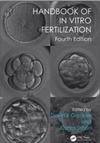 Handbook of In Vitro Fertilization 4 edition