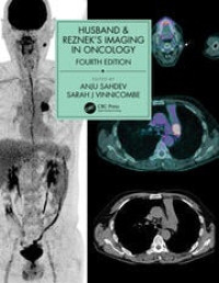 Husband & Reznek's imaging in oncology 4th edition