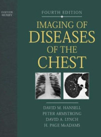 IMAGING of diseases of the chest, 4th ed. edited by David M.Hansell [et.al.]